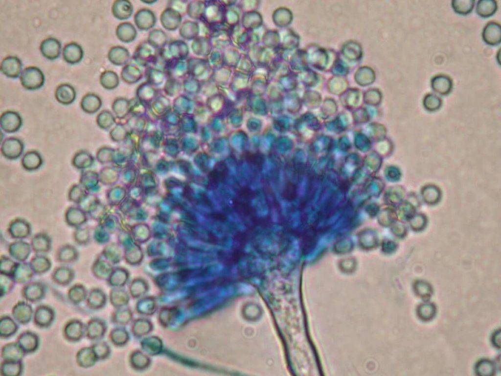 aspergillus versicolor 1